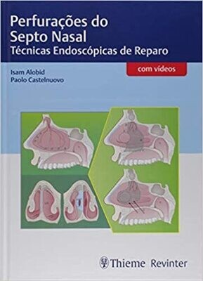 Perfurações do Septo Nasal: Técnicas Endoscópicas de Reparo