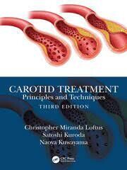 Carotid Treatment: Principles and Techniques 3rd Edition