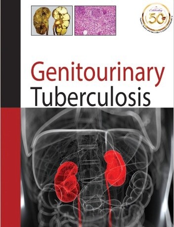 Genitourinary Tuberculosis