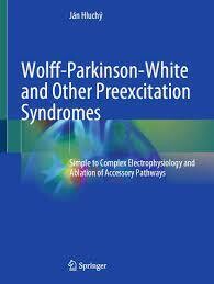 Wolff-Parkinson-White and Other Preexcitation Syndromes
Simple to Complex Electrophysiology and Ablation of Accessory Pathways