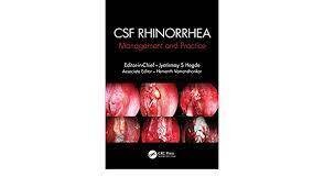 CSF Rhinorrhoea: Management and Practice 1st Edition