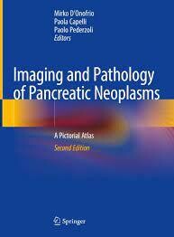 Imaging and Pathology of Pancreatic Neoplasms
A Pictorial Atlas