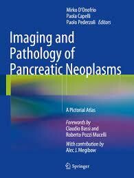 Imaging and Pathology of Pancreatic Neoplasms
A Pictorial Atlas