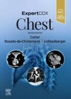 ExpertDDx: Chest 2nd Edition