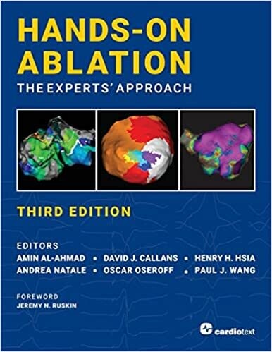 Hands-On Ablation: The Experts&#39; Approach, Third Edition 3rd Edition(EPUB)