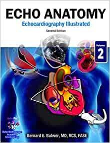 Echo Anatomy, 2nd edition (Echocardiography Illustrated) (Volume 2)