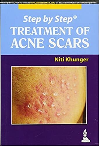 Step by Step Treatment of Acne Scars 1st Edition