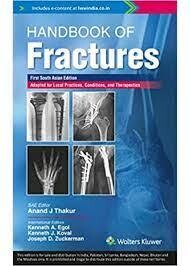 Handbook Of Fractures