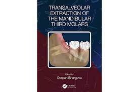 Transalveolar Extraction of the Mandibular Third Molars 1st Edition