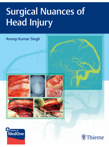 Surgical Nuances of Head Injury