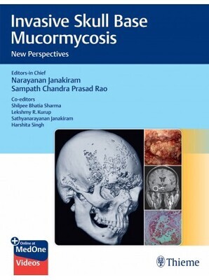 Invasive Skull Base Mucormycosis