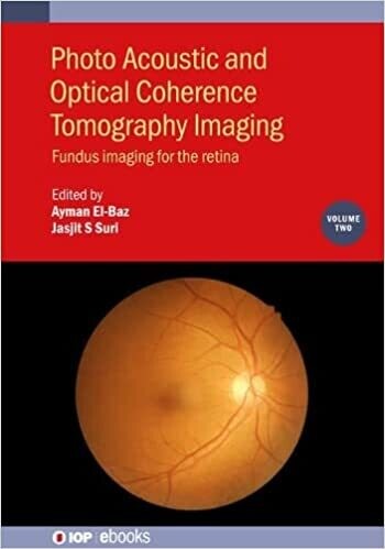 Photo Acoustic and Optical Coherence Tomography Imaging: Fundus Imaging for the Retina (Volume 2)