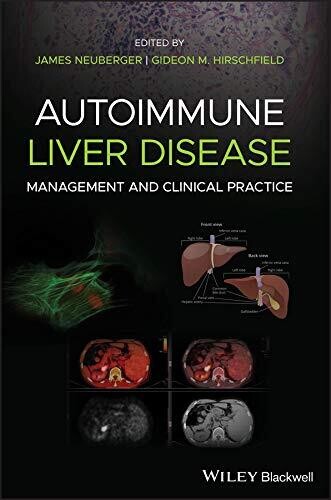 Autoimmune Liver Disease: Management and Clinical Practice 1st Edition