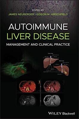 Autoimmune Liver Disease: Management and Clinical Practice 1st Edition