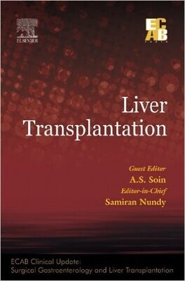 Liver Transplantation