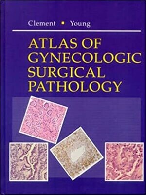 Atlas of Gynecologic Surgical Pathology