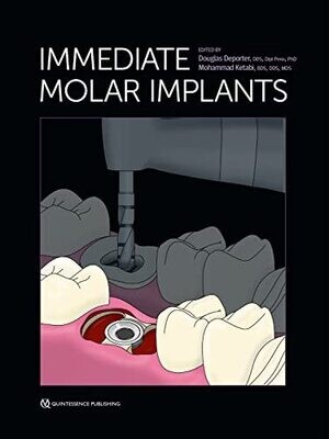 Immediate Molar Implants