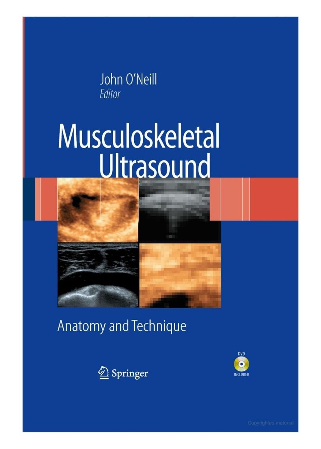 Musculoskeletal Ultrasound Anatomy and Techniques