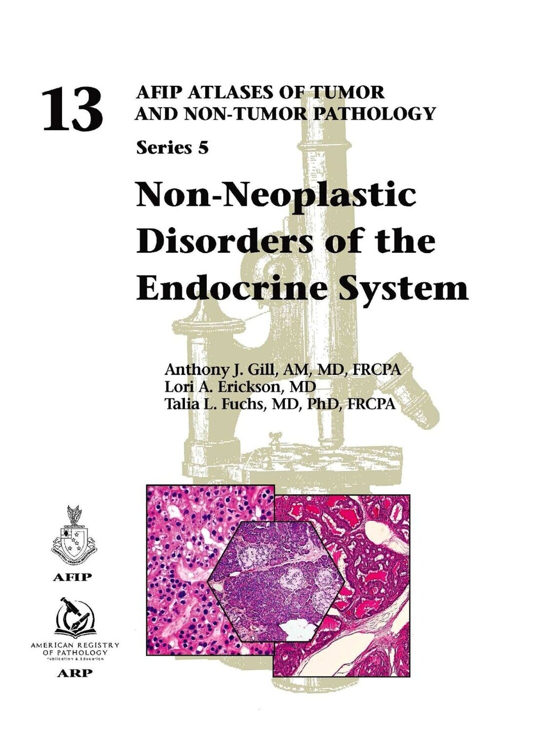 Non-Neoplastic Disorders of the Endocrine System (AFIP Atlas of Tumor and Non-Tumor Pathology, Series 5) by American Registry of Pathology