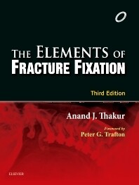 Elements of Fracture Fixation
3rd Edition