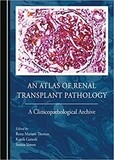 An Atlas of Renal Transplant Pathology 2023