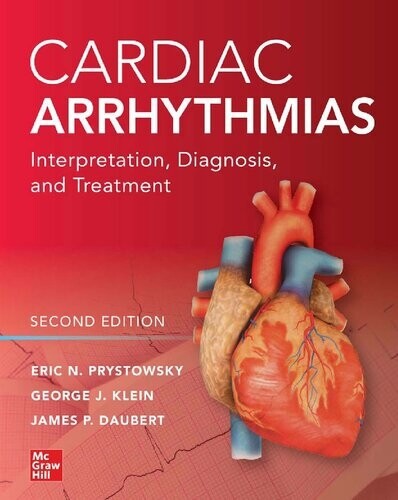 Cardiac Arrhythmias Interpretation, Diagnosis and Treatment