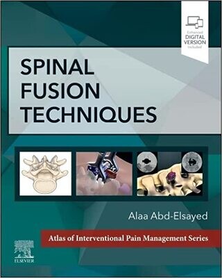 Spinal Fusion Techniques 1st Edition