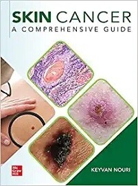 Skin Cancer A Comprehensive Guide 2023