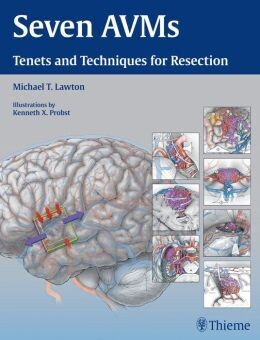 Seven AVMs: Tenets and Techniques for Resection