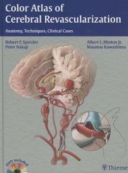 Color Atlas of Cerebral Revascularization: Anatomy, Techniques, Clinical Cases: Anatomy, Techniques, Clinical Cases