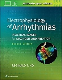 Electrophysiology of Arrhythmias Practical Images for Diagnosis and Ablation 2nd Edition 2023