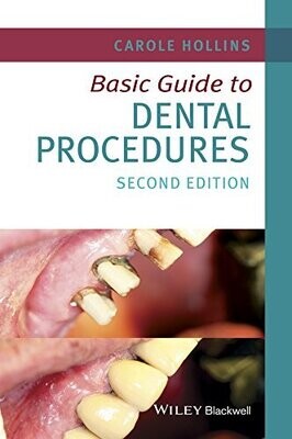 Basic Guide to Dental Procedures (Basic Guide Dentistry Series) 2nd Edition