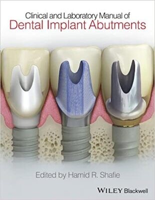 Clinical and Laboratory Manual of Dental Implant Abutments 1st Edición
