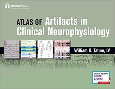 Atlas of Artifacts in Clinical Neurophysiology 1st Edition