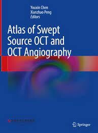 Atlas of Swept Source OCT and OCT Angiography