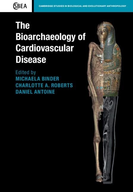 The Bioarchaeology of Cardiovascular Disease (Cambridge Studies in Biological and Evolutionary Anthropology Book 91)