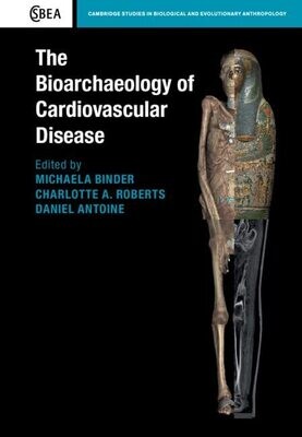 The Bioarchaeology of Cardiovascular Disease (Cambridge Studies in Biological and Evolutionary Anthropology Book 91)
