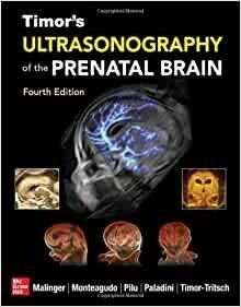 Timor&#39;s Ultrasonography of the prenatal brain