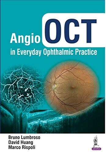 Angio OCT in Everyday Ophthalmic Practice 1st Edition