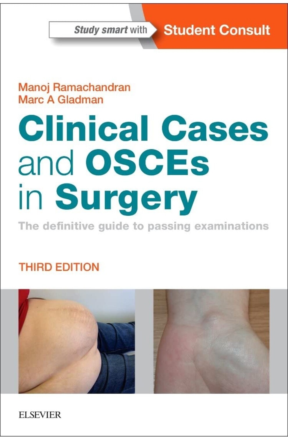 Clinical Cases and OSCEs in Surgery The Definitive Guide to passing Examinations Third Edition 2023