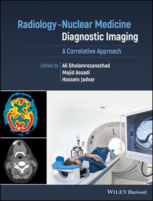 Atlas of Pulmonary Vascular Imaging: A Multimodality Approach