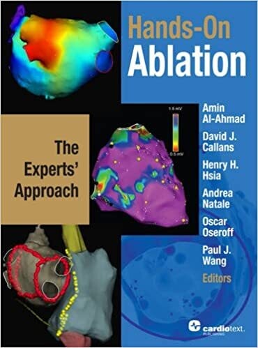 Hands-on Ablation: The Experts&#39; Approach 1st Edition