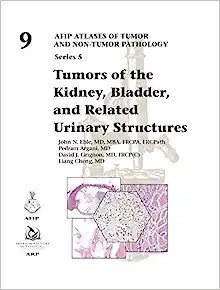 Tumors of the Kidney, Bladder, and Related Urinary Structures (AFIP Atlases of Tumor and Non-tumor Pathology, Series 5, Volume 9)