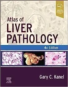 Atlas of Liver Pathology 4th Edition 2023