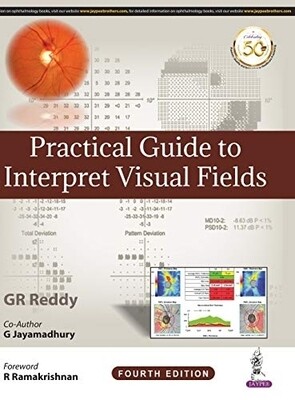 Practical guide to interpret visual fields