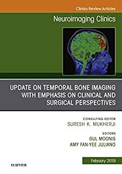 Temporal Bone Imaging: Clinicoradiologic and Surgical Considerations, An Issue of Neuroimaging Clinics of North America (The Clinics: Radiology Book 29) Temporal Bone Imaging: Clinicoradiologic and Su