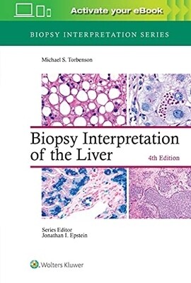 Biopsy Interpretation of the Liver 4th Edition 2023 (Biopsy Interpretation Series)