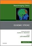 Ischemic Stroke, An Issue of Neuroimaging Clinics of North America (Volume 28-4)