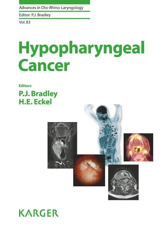 Hypopharyngeal cancer