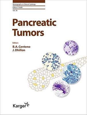 Pancreatic Tumors (Monographs in Clinical Cytology, Vol. 26)